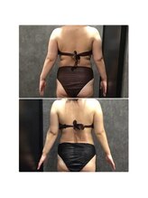 フローボディ 新山口店(flow BODY)/山口のエステはflow BODY