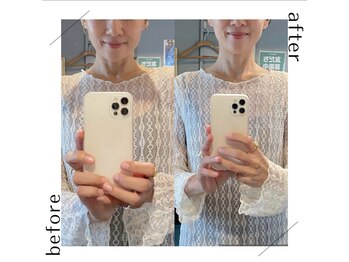 キワミ(KIWAMI)の写真/「疲れが取れない原因は首の歪み。首を整え自律神経もケア」首こりや歪みを整え慢性疲労をスッキリ爽快！