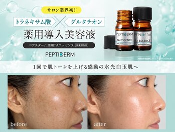 エメ(Aimer)の写真/【水光白玉フェイシャル】色むら・赤ら・くすみ・・シミケア★透き通るような水光ツヤ肌へ