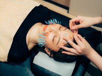 くすの樹接骨院 整体院 町田院/[美容鍼/鍼灸]リフトアップ/小顔