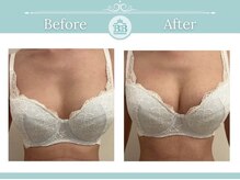 美人バスト 掛川店/【バストアップ/育乳静岡/掛川】