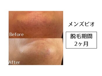 メンズビオ 神戸三宮店/