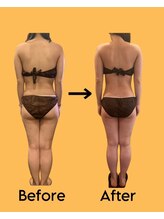 ビューティースタイリング 恵比寿店(beauty styling)/【ボディ】食べて痩せる☆