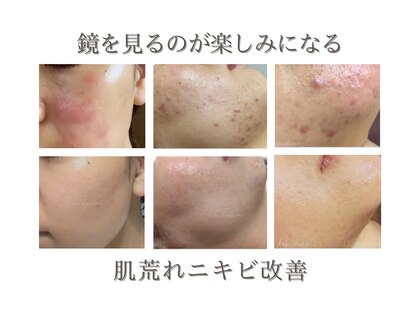 ミーラブ 鹿児島(miilove)の写真