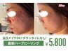 1週間の奇跡【痛みのない次世代ハーブピーリング】当日メイクもOK！/初回価格