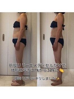 ホロニック ベルサンテ(Holonic Belle Sante)/メディセルハイブリッド