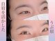 リープ(liip)の写真