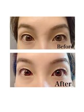 ノーブル(Noble)/