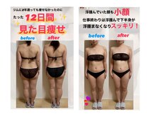 ヨサパーク リュミエール 松本店(YOSAPARK lumiere)の雰囲気（食事制限なしでも1ヶ月半で通っただけで痩せました！）