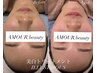 《facial人気no.1》ダウンタイム無しAMOUR式贅沢フェイシャルコース40700円→