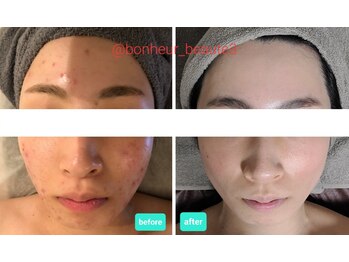 ボーテボナー(Beaute Bonheur)/♪フェイシャル♪