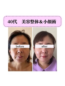 エリーズ(Elise)/美容整体＆骨格矯正