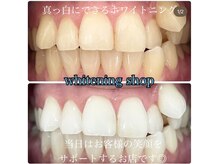 ホワイトニングショップ 柏店/美白ホワイトニング