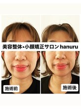 ハヌル(hanuru)/小顔ボディ　(hanuru式美容整体)
