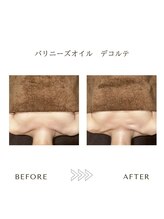 サロンエイトミー 西船橋店(salon 83)/バリニーズオイル/before→after