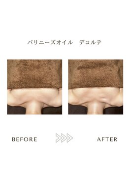 サロンエイトミー 西船橋店(salon 83)/バリニーズオイル/before→after