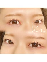 クレー(Klee)/ラッシュリフト