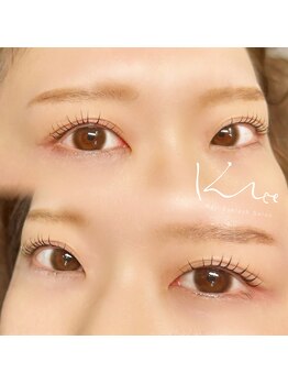 クレー(Klee)/ラッシュリフト