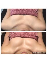 ヴィノス 京都烏丸店(vinos)/１回で驚きのバストアップ