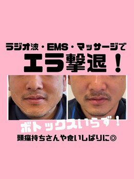 デスティン(Destin)/気になるエラをしっかりほぐす！