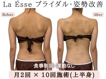 ラエッセ(La Esse)の写真