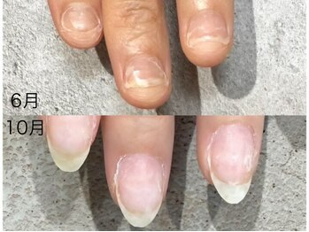 グレースレディ 神戸北店/