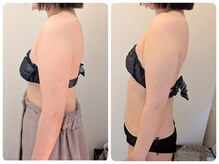 ワイズ(Y's)/背中&二の腕　7回目