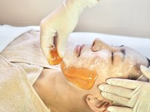 モア30(more30)/【施術風景】シュガーリング脱毛