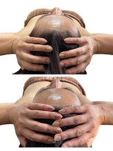 スカイ(sky)/頭蓋骨立体小顔矯正