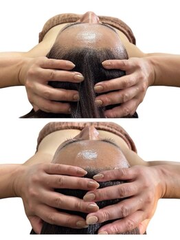 スカイ(sky)/頭蓋骨立体小顔矯正