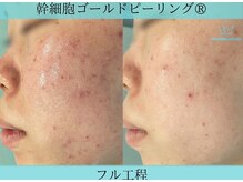 リメイククリニカルビューティー(Remake clinical beauty)/