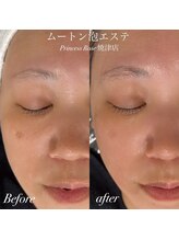 キレイシェア バイ プリンセスローズ静岡駅店(KIREI SHARE)/ムートン泡エステ