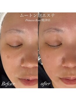 キレイシェア バイ プリンセスローズ静岡駅店(KIREI SHARE)/ムートン泡エステ