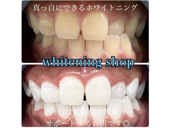 ホワイトニングショップ 柏店/美白ホワイトニング