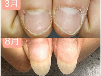 グレースレディ/ロングネイルも楽しめるように！