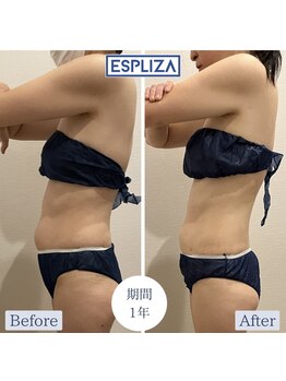 エスプライザ 鹿児島天文館店(ESPLIZA)/