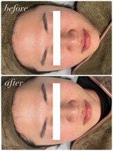 セローナ(Selona)/男性の方も◎