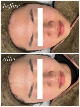 セローナ(Selona)/男性の方も◎