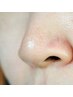 【毛穴集中】黒ずみ＆開きケア40分　毛穴汚れをすっきり洗浄！何度でもOK