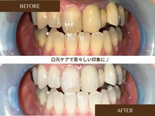 エシル(ecil)の雰囲気（しみないホワイトニングでパッと明るい表情に◎口臭対策にも◎）