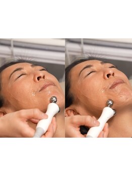 ホウレイ線・たるみ改善！予防ケア