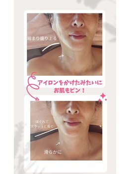 ニワ(Niwa)/バザルトフェイシャル施術例