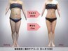 【短期痩身保障プラン】インディバ×ハイパーナイフ5回×60分／1回あたり7000