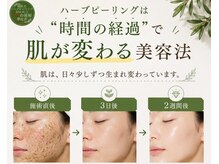 ラビジェ(Labbija)の雰囲気（フェイシャル・肌質改善もお任せ）
