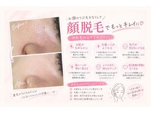 エステティックレイビス 弘前店(RAYVIS)