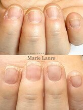 マリーロール 梅田店(Marie Laure)/自爪育成/深爪矯正/ネイルケア