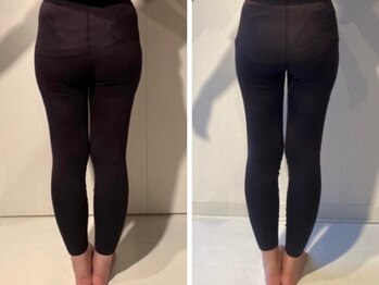 エスアップ 麻布十番店(THE S-UP)/施術前後写真