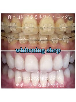 ホワイトニングショップ 柏店/美白ホワイトニング