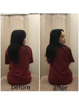 駒込整体院/～ビフォーアフター～骨盤矯正