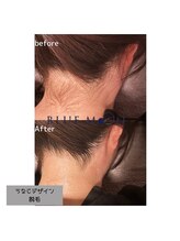 ブルームーン(BLUE MOON)/うなじ脱毛デザインシェービング